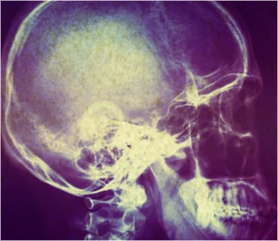ANORMAL146_image6